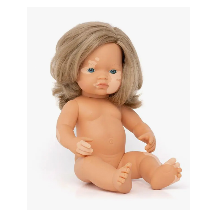 Puppe blondes Mädchen mit Vitiligo